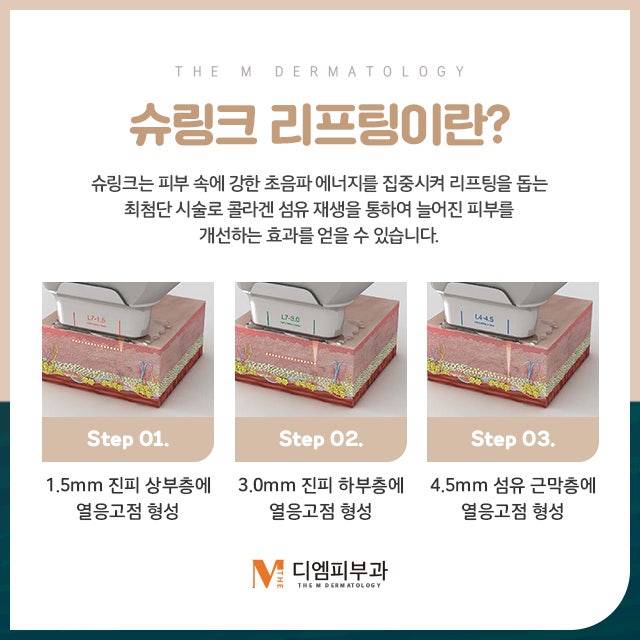 압구정동슈링크 리프팅으로 탄력도 잡고 피부도 놓치지 마세요!