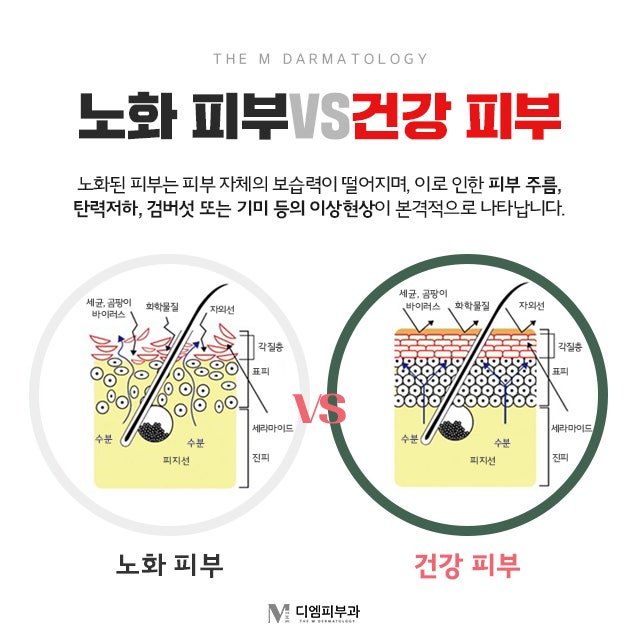 튠라이너잘하는피부과 이중턱 개선 UP! 리프팅 효과 UP!
