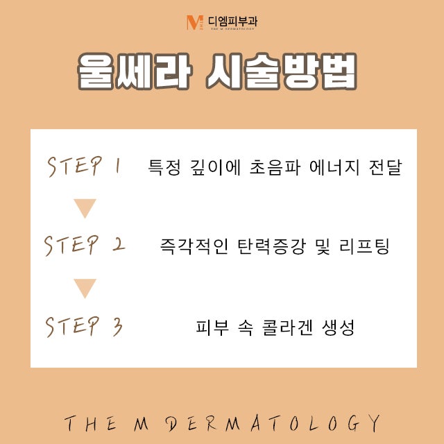 압구정동울쎄라에서 완벽한 리프팅 사진 4