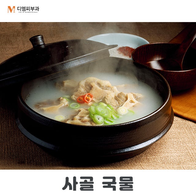 장에좋은음식7가지 알아보고 건강 챙기기! 사진 5