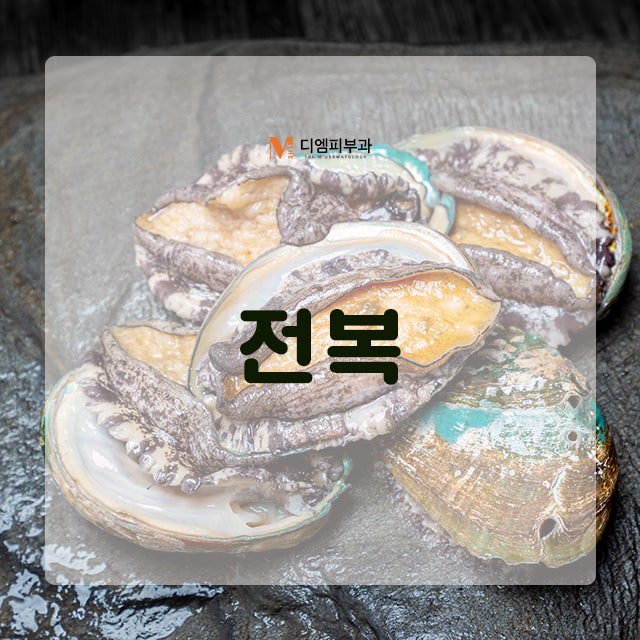 여름에먹으면좋은음식들로 여름 건강 관리하기! 사진 8