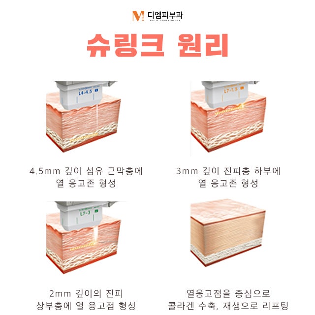 동작역슈링크로 완벽한 페이스, 바디 리프팅 사진 4
