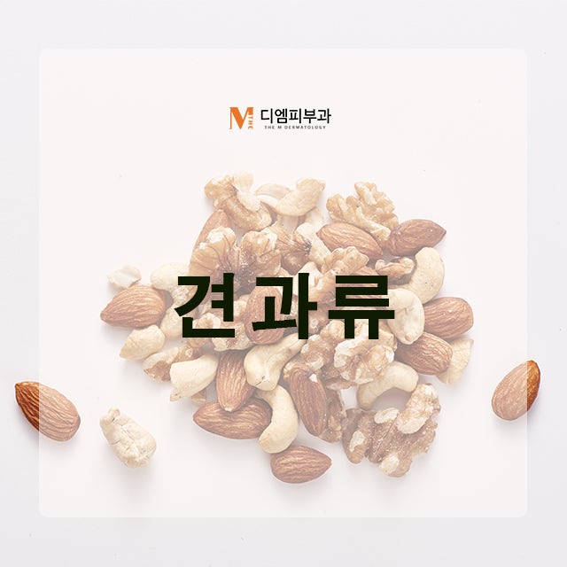 간에좋은음식 증상과 좋은 음식을 알아보자 사진 4