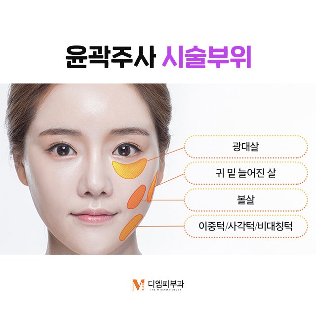 압구정동윤곽주사 원하는 부위 집중 관리! 사진 5
