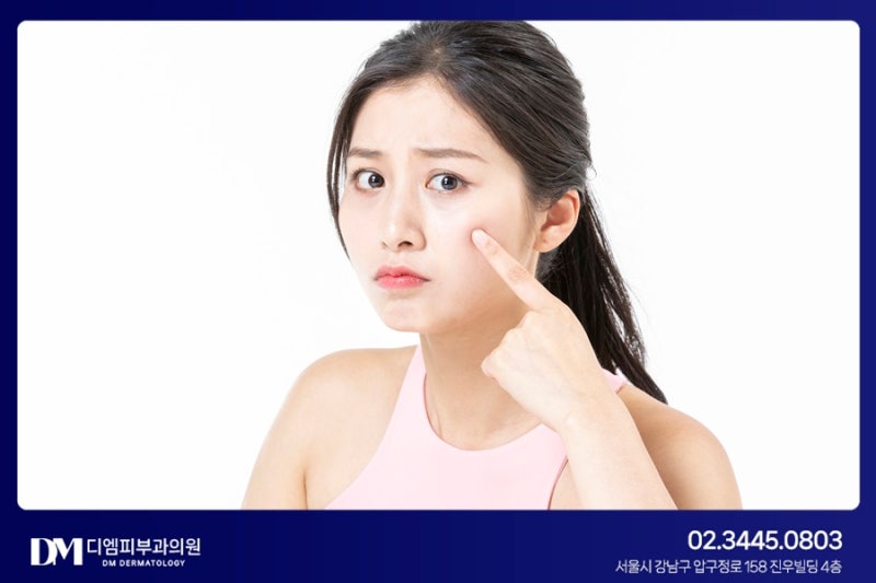 여드름 흉터 치료 :: 흉터 모양, 깊이에 따라 적절한 치료 사진 5