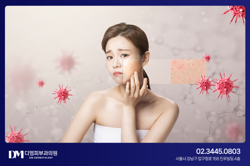아쿠아필 효과 어떻게 나타날까?