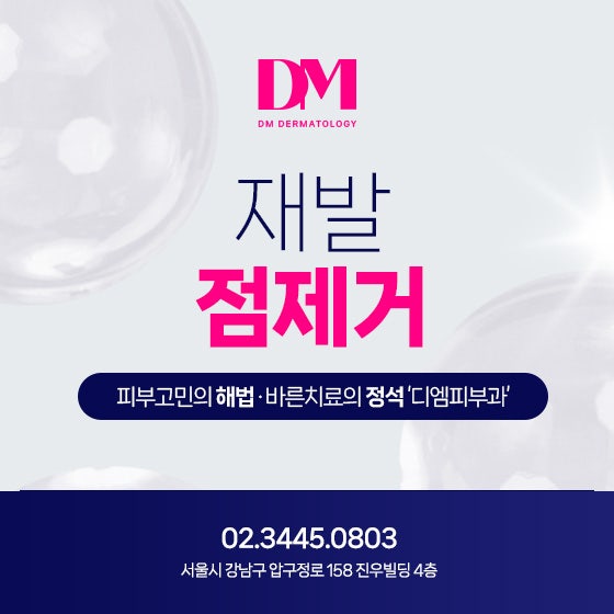 점 제거 후 재발막는 방법 알려드려요