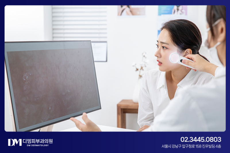 모공 크기 줄일 수 있나요? 압구정피부과전문의의 섬세한 관리 사진 5