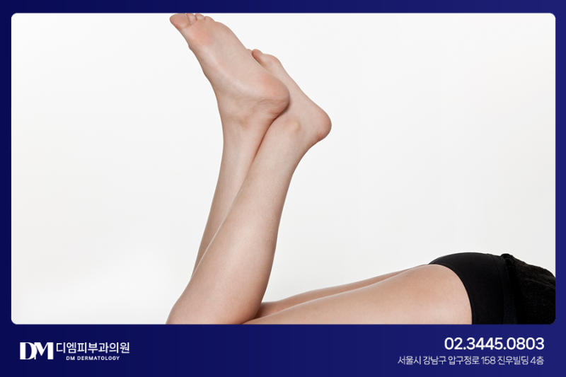 여름맞이 종아리, 허벅지 근육 개선하는 바디보톡스