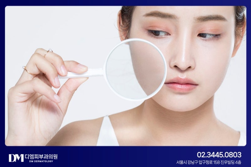 기미잡티 제거, 색소질환 종류에 따라 치료법이 달라요!
