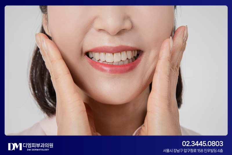 깊어지는 팔자주름 필러로 개선해요