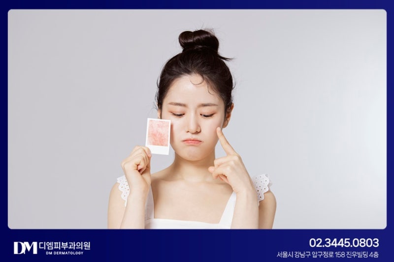 여드름 자국 개선, 프락셀 맞춤 치료가 중요해 사진 3