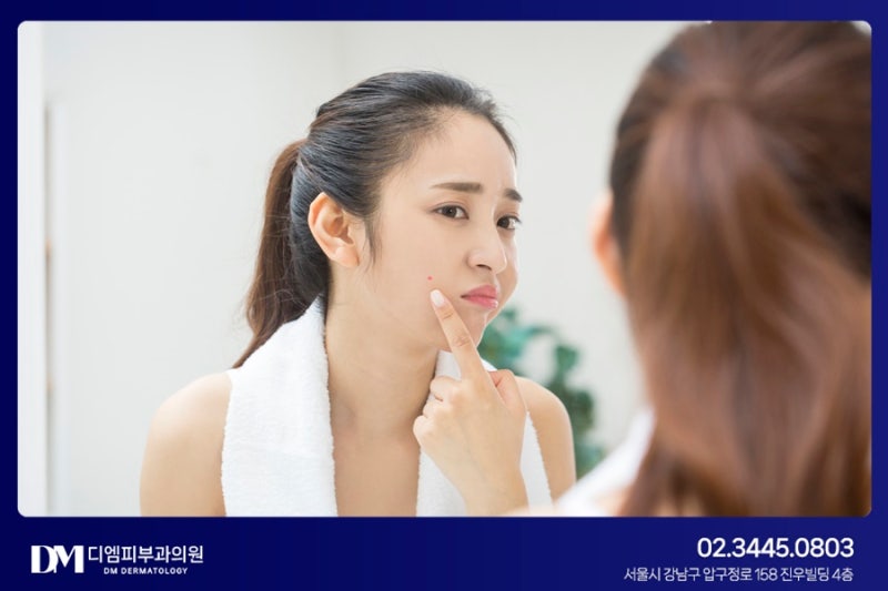 재발 쉬운 여드름, 흉터가 고민이라면? 사진 3