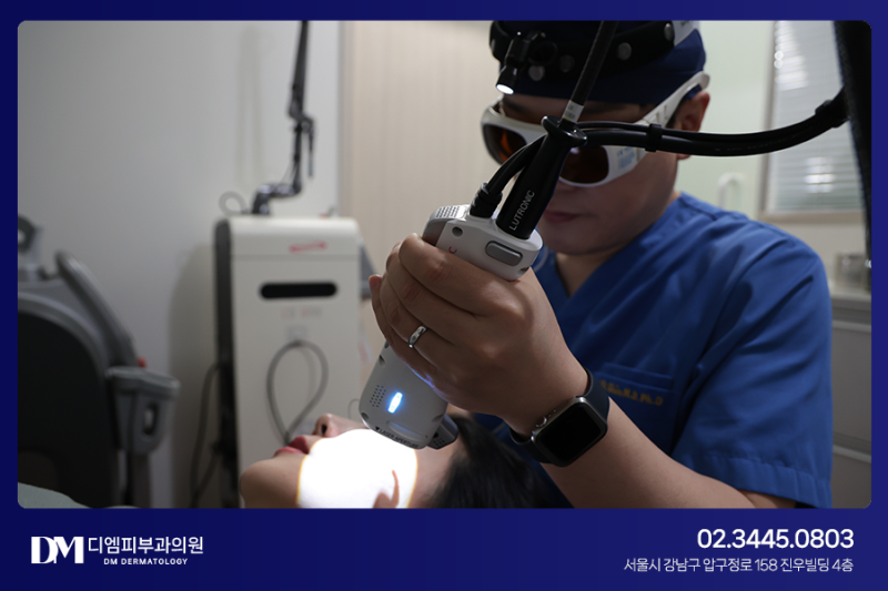 여드름 흉터 자국 없애는 포텐자, 프락셀 레이저! 사진 4