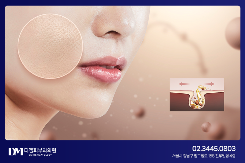 모공 축소, 정말 불가능한 일일까? 사진 3