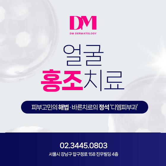 민망한 붉은 얼굴, 쿼드로스타 홍조레이저로 개선해요