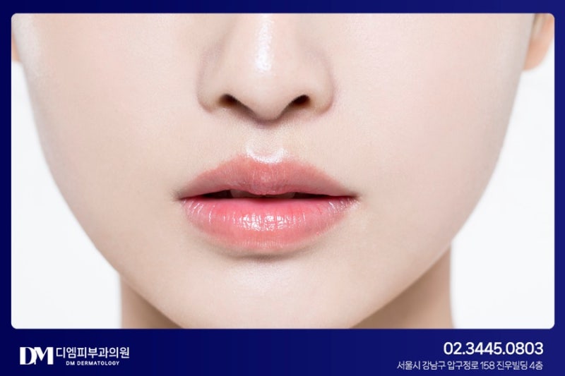 나만의 톡톡 튀는 입술, 필러로 디자인하다 사진 4
