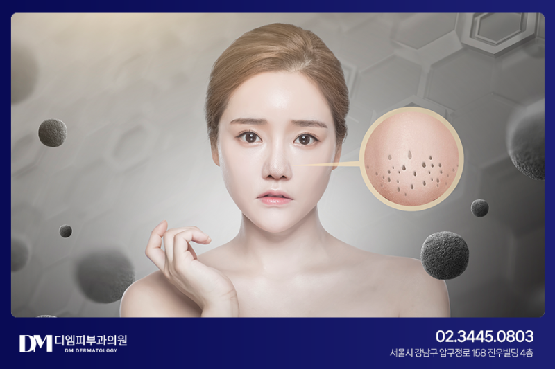 모공 속 노폐물을 제거하는 아쿠아필, 시술원리와 발생할 수 있는 부작용 사진 5