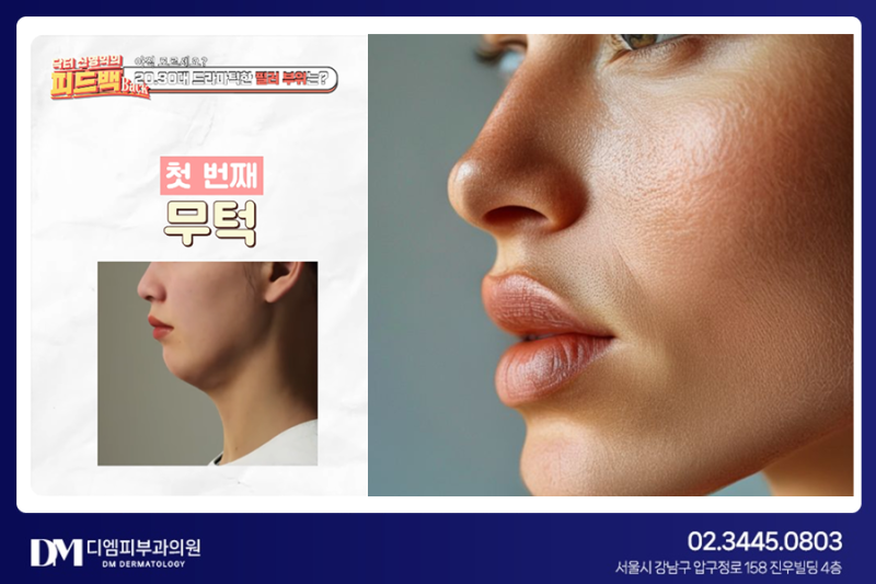 동안 얼굴 완성! 자연스럽게 예뻐지는 필러 추천 부위 TOP3 사진 3
