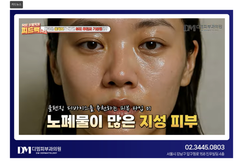 홈케어 제품, 제대로 알고 사용하고 있나요? 리들샷·클렌징 디바이스, 피부 타입별 사용법 총정리! 사진 4