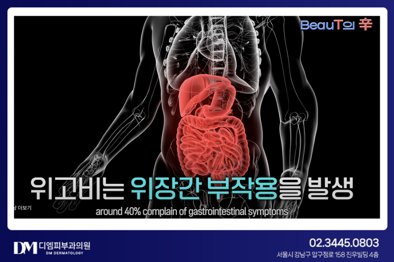 요즘은 삭센다보다 위고비? 피부 난리납니다! 사진 4