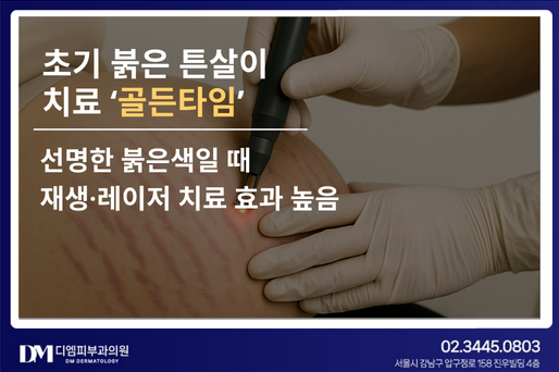 임산부 튼살, 생기기 전에 막을 수 있을까? 생긴 후 임산부 튼살 치료까지 완벽 정리 사진 3