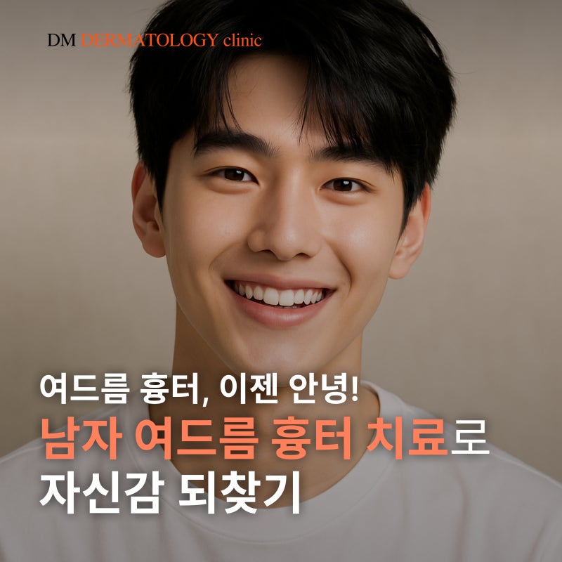 30대 남성 여드름 흉터 치료 1회 후기, 디엠피부과에서 알려드립니다.