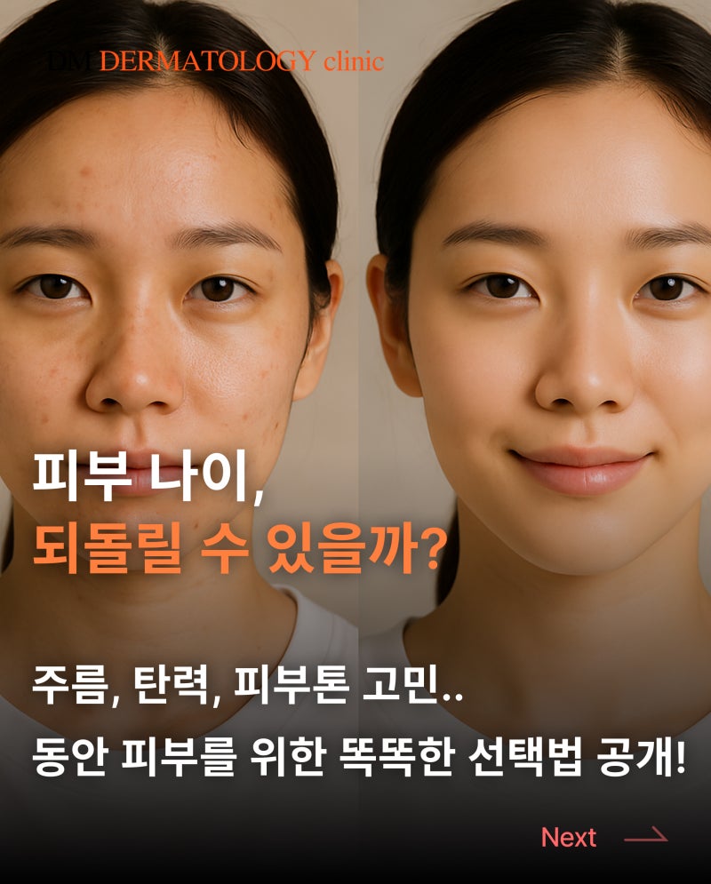 동안 피부를 위한 최적의 시술 선택법, 내 피부에 맞는 솔루션은?