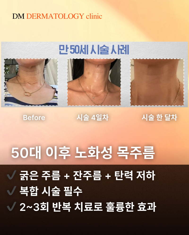 목주름 치료, 실제 목주름 시술 환자 후기와 피부과 전문의 꿀팁 사진 3
