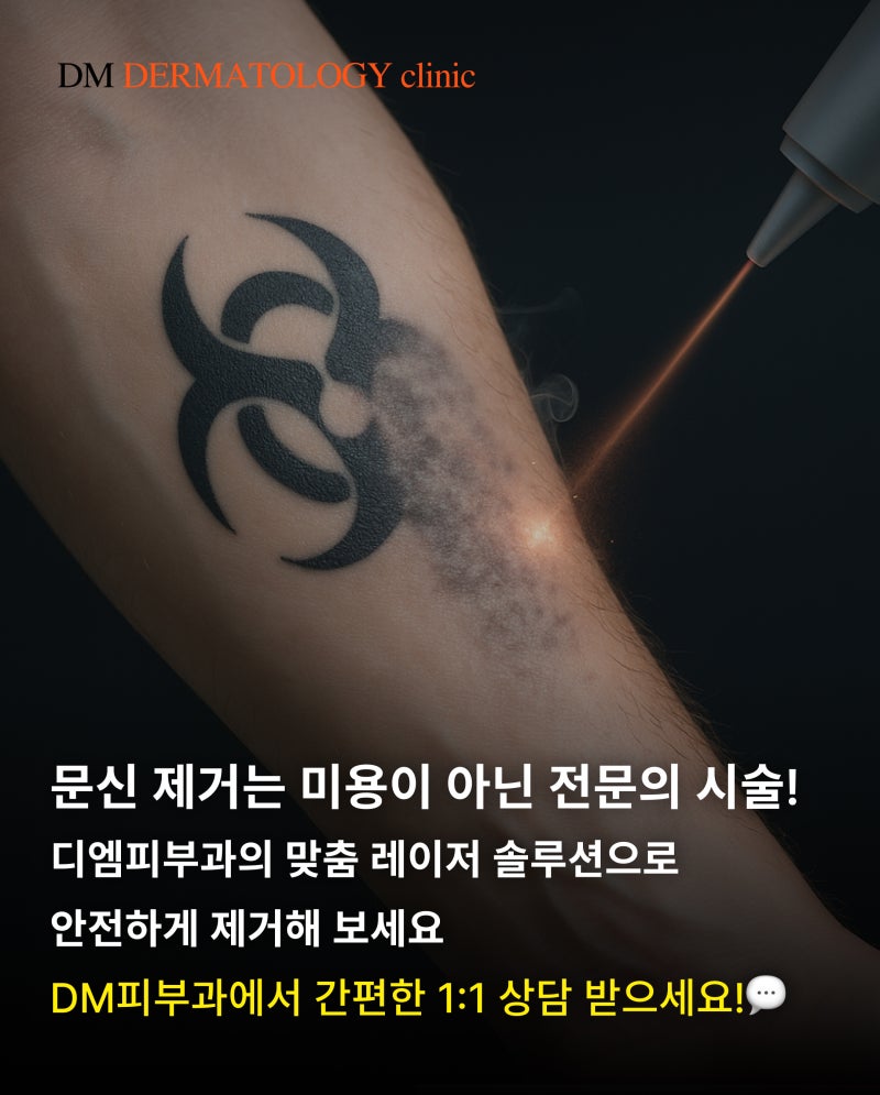 문신 제거 비용, 시간 총정리! 타투 지우기 전 꼭 알아야 할 3가지 핵심 포인트 사진 6