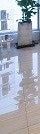 중년 피부과 시술 50대 ~ 60대 이용 가이드 사진 19