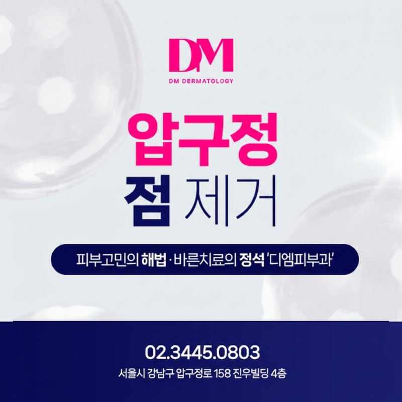 압구정점제거 피부과에서 알려주는 사후 관리법
